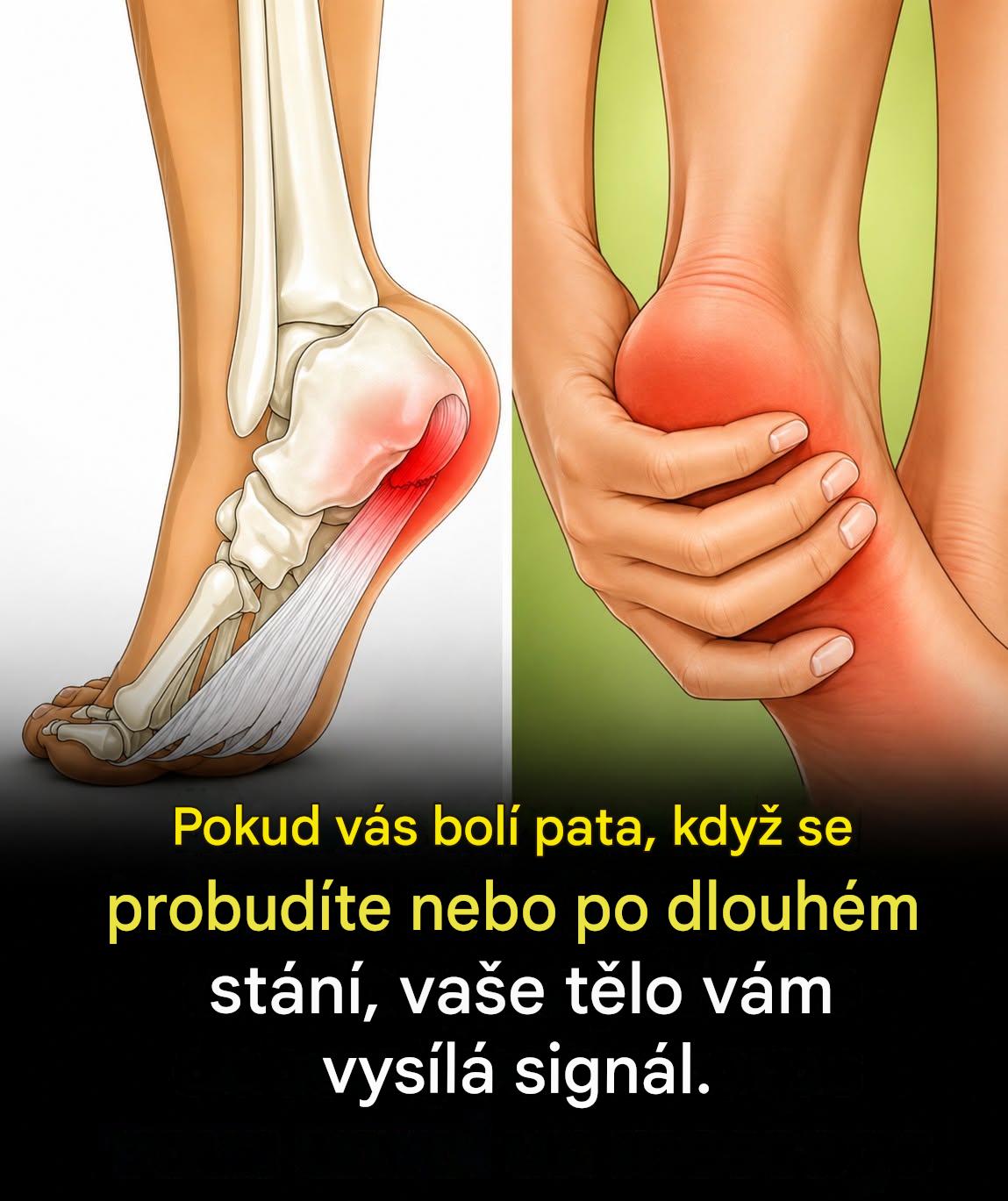 Přirozeně ulevit od plantární fasciitidy pomocí 7 jednoduchých a účinných cviků