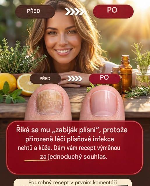 Hřebíček proti plísním nehtů a kůže: účinné domácí prostředky