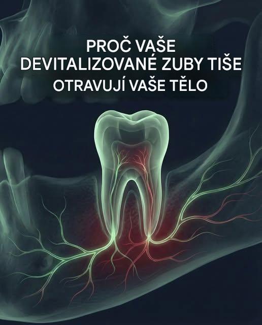 Smrtelné nebezpečí, které před vámi váš zubař skrývá ohledně ošetření kořenových kanálků zubů