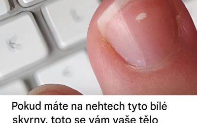 Bílé skvrny na nehtech: mýtus, nebo varovný signál?