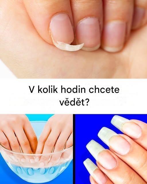 Jak lze urychlit růst nehtů?