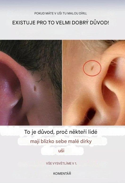 Má vaše dítě malou díru v uchu? Zde je to, co to je