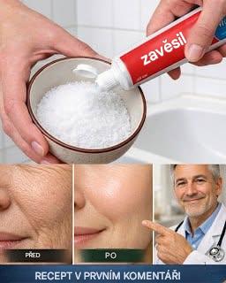Vypadá to jako kosmetická chirurgie! Přírodní recept na vyhlazení vrásek a nedokonalostí na rukou a pažích.