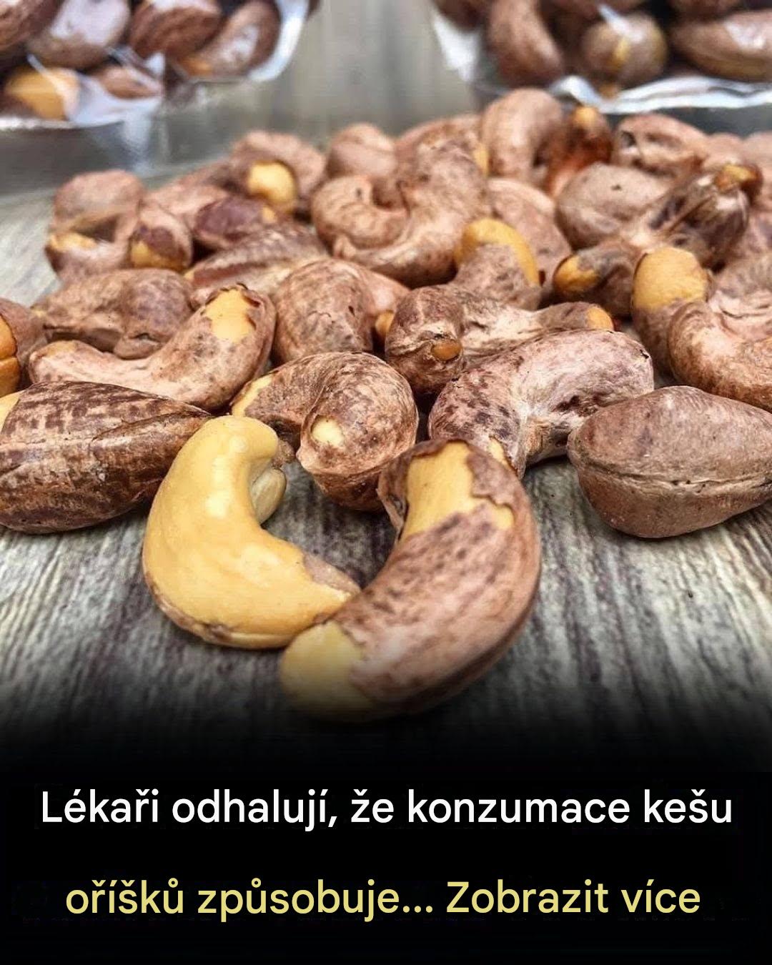 Lékaři odhalují, že konzumace kešu oříšků způsobuje…