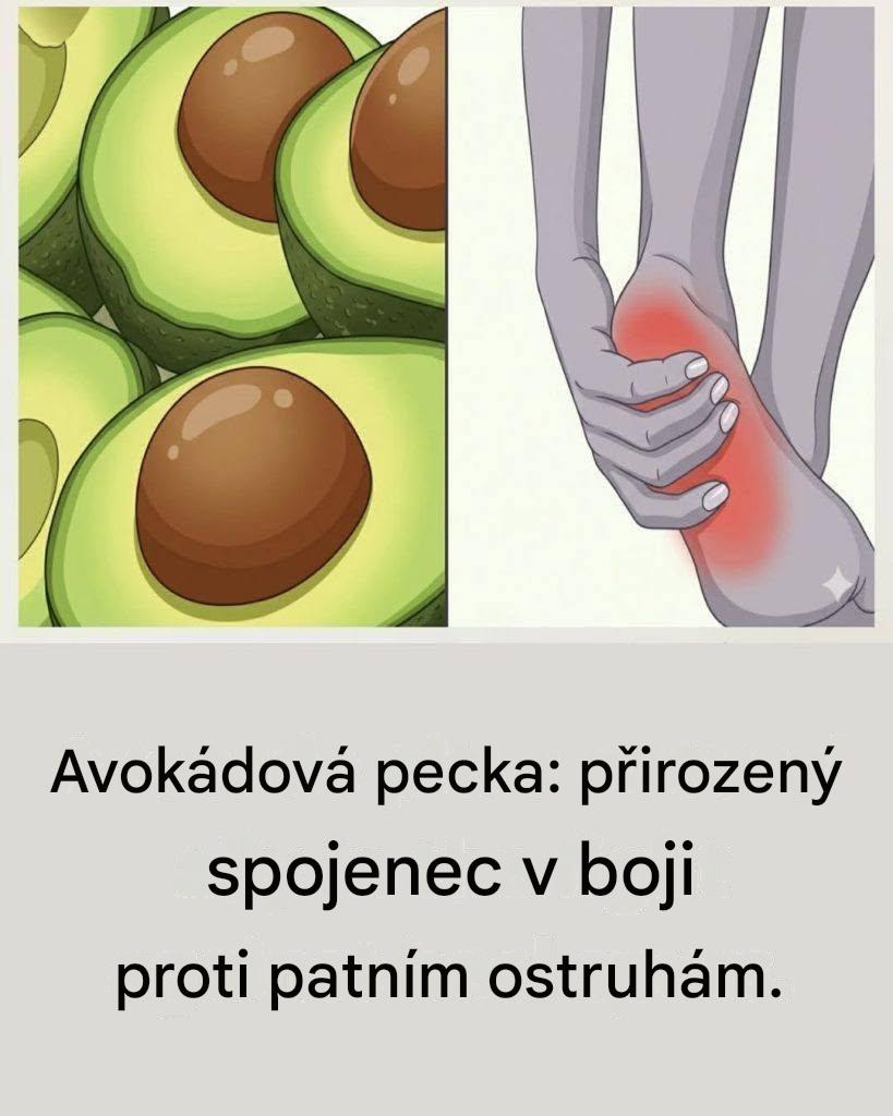 Jak použít pecku avokáda k úlevě od patních ostruh…Zobrazit více