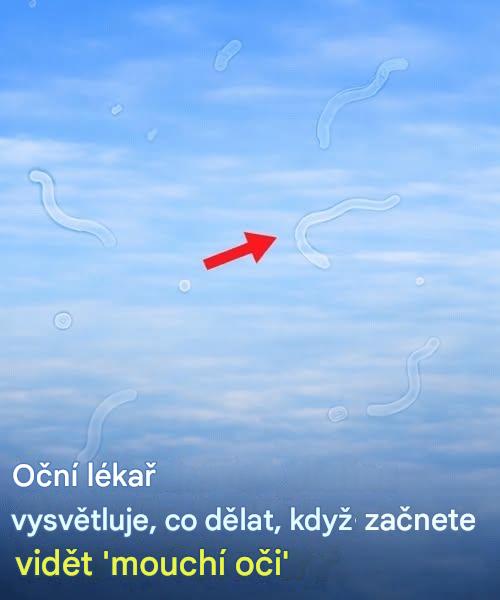 Co dělat, když se vám v očích začnou objevovat mouchy: užitečný průvodce pro oftalmologa