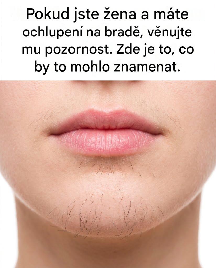 Ženská brada a neočekávaný růst ochlupení: dekódování příčin a řešení