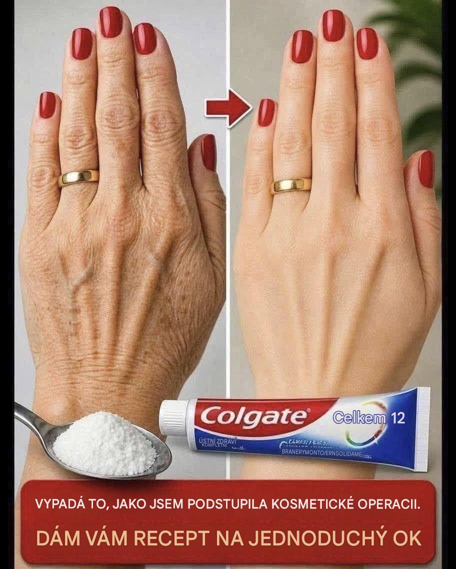 Podívejte se na to… Ty ruce vypadaly staře, plné skvrn… Více se dočtete v prvním komentáři