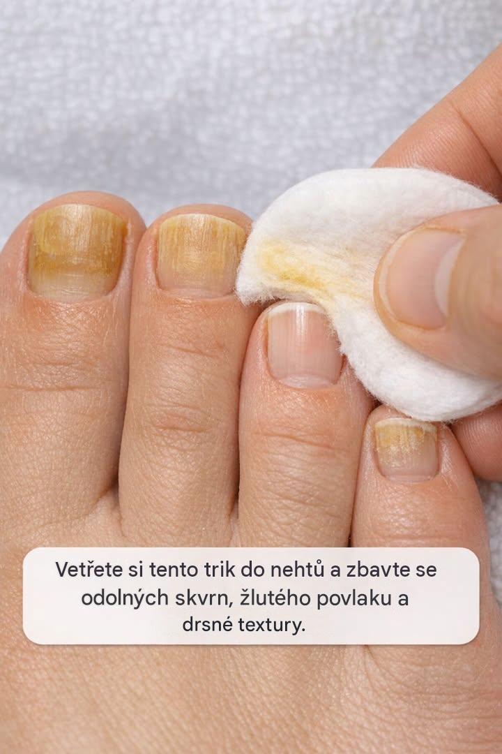 Vetřete si tento trik do nehtů a zbavte se odolných skvrn, žlutého povlaku a drsné textury.