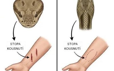 Co dělat po uštknutí hadem: základní kroky první pomoci, které mohou znamenat velký rozdíl