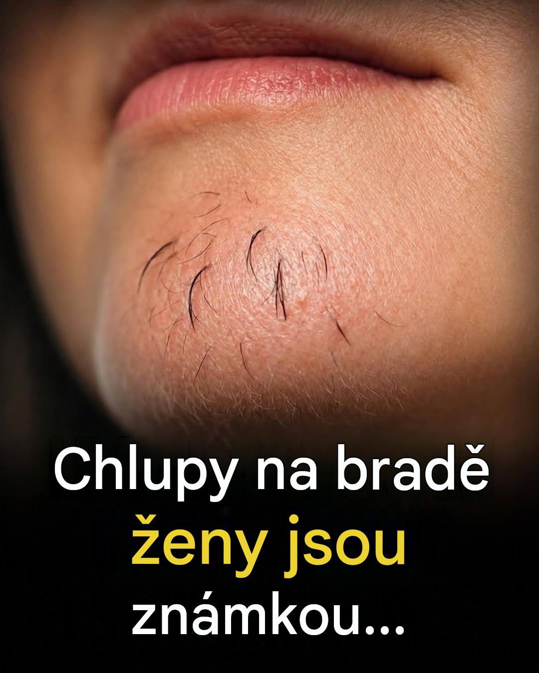 Chloupky na bradě u žen: co se vám vaše tělo může snažit říct