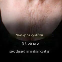 Vrásky v dekoltu: 5 tipů, jak jim předcházet a redukovat je