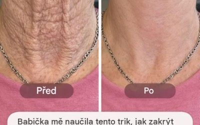 Moje babička mě naučila tento trik, jak skrýt zvracení na krku za pouhých 5 minut bez námahy. Funguje to takto.