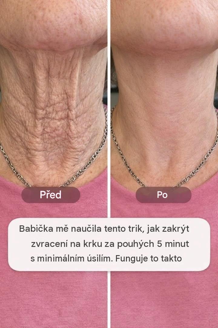 Moje babička mě naučila tento trik, jak skrýt zvracení na krku za pouhých 5 minut bez námahy. Funguje to takto.