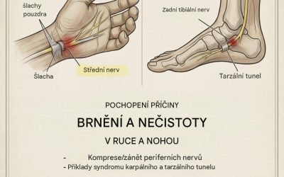 Pokud vám necitliví ruce, znamená tohle… Zobrazit více