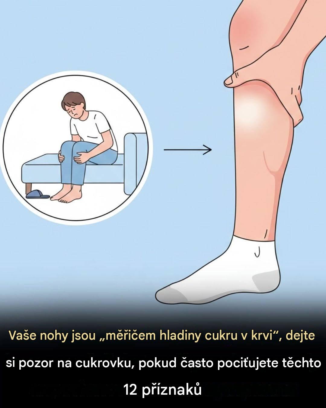 Vaše nohy jsou „měřičem hladiny cukru v krvi“ – ​​dejte si pozor na cukrovku, pokud často pociťujete těchto 12 příznaků